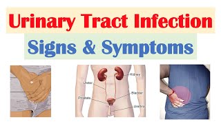 Urinary Tract Infection UTI Signs amp Symptoms amp Why They Occur [upl. by Relyat]