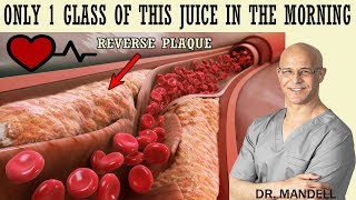 1 GLASS OF THIS JUICE IN THE MORNINGREVERSE CLOGGED ARTERIES amp LOWER HIGH BLOOD PRESSURE [upl. by Lacim692]