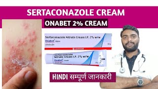 Sertaconazole cream in hindi  Onabet cream  Sertaconazole ointment [upl. by Illyes]