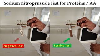 Quantitative Analysis Of Protein [upl. by Car]