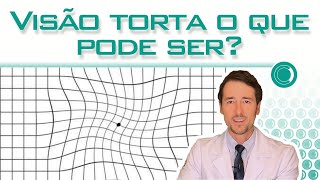 Visão torta o que pode ser [upl. by Elum]