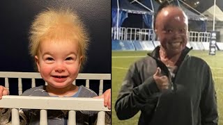 Uncombable Hair Syndrome and Other Rare Genetic Conditions [upl. by Dloreh295]