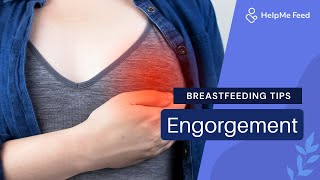 Breastfeeding Tips Engorgement [upl. by Casavant]