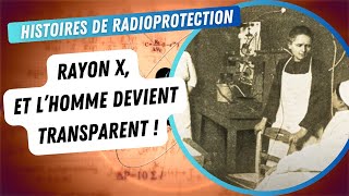 Les rayons X  Et lhomme devient transparent [upl. by Farris]