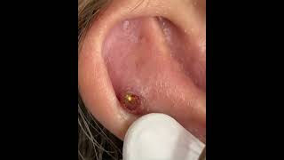 Piercings en apuros piercing piercer videopiercing failpiercing [upl. by Welbie437]