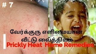 Verkuru Neengapoga Simple Home Remedies in Tamil  Treatment Tips for Prickly Heat in Tamil [upl. by Alikahs]