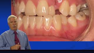 Rondeau Seminars Orthodontics Level II Sample Case  Mai Part 1 [upl. by Skinner]