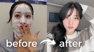 extreme glow up in korea 🇰🇷 glass hair nail art haircut amp color LED lashes laser skin treatments [upl. by Tatia]