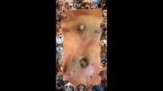 Blackhead Removal  18  Blackhead extraction  blackheads [upl. by Catrina277]