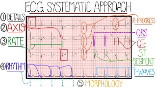 ECG Interpretation Made Easy Learn How to Interpret an ECG in 13 Minutes [upl. by Leziar]