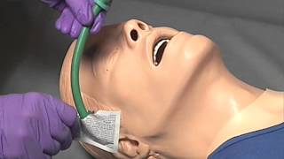 EMS Skills  Nasopharyngeal Airway Insertion [upl. by Arakaj972]