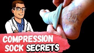 BEST Compression Socks TIPS How To Fix Swollen Feet Ankles amp Legs [upl. by Enaffit]