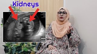 how to know gender of baby on ultrasound  pyelectasis of fetus shows baby boy  gender reveal scan [upl. by Julienne]