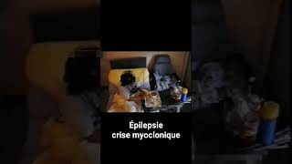 Epilepsie  crise myoclonique du réveil [upl. by Borreri]