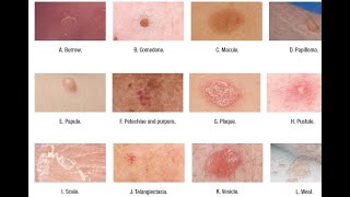 Skin Lesions with defination [upl. by Jennette]