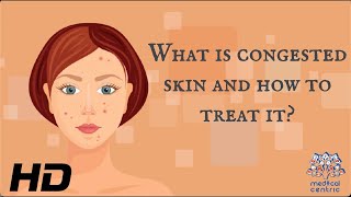 What Is Congested Skin And How To Treat It [upl. by Eralc]