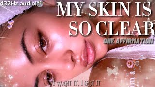 432Hz  My skin is so clear ONE AFFIRMATION [upl. by Tshombe260]