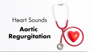 Aortic Regurgitation  Heart Sounds  MEDZCOOL [upl. by Nuy]