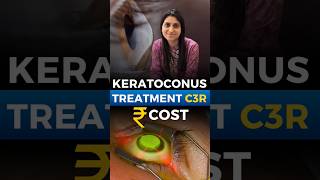 Keratoconus Treatment Cost C3R [upl. by Tijnar]