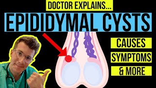 Doctor explains TESTICULAR LUMPS PART 1  EPIDIDYMAL CYSTS causes symptoms and treatments [upl. by My]