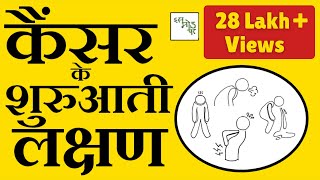 Common cancer signs Hindi Cancer Ke Shuruati Lakshan  Cancer early signs hindi [upl. by Acinoryt]