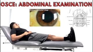 OSCE Abdominal Examination [upl. by Anifesoj473]