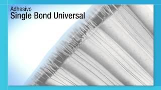 Nuevo Adhesivo Single Bond Universal de 3M ESPE [upl. by Branham]