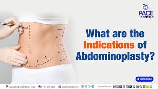 Abdominoplasty Indications  What are the Indications of Abdominoplasty  Abdominoplasty [upl. by Neahs]