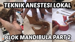 Teknik Anestesi Lokal Blok Mandibula PART 2 [upl. by Arny888]