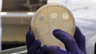 Titering Phage  spot and whole plate methods [upl. by Woody]