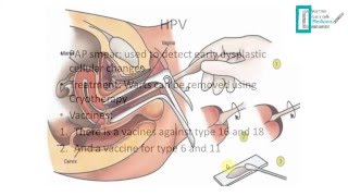 STDs Overview [upl. by Radbourne]