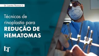 TÉCNICAS DE RINOPLASTIA PARA REDUÇÃO DE HEMATOMAS  DR LAERTES THOMAZ JR [upl. by Graniah]