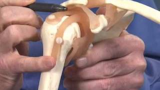 Shoulder Impingement  Dr Richard Hawkins [upl. by Mert546]