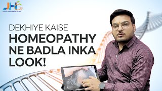 Dekhiye kaise homeopathy treatment ne badla inka look Dr Deepak tak [upl. by Nuhs]