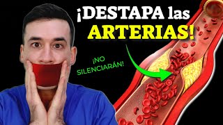 DESTAPA LAS ARTERIAS ¡SIN REMEDIOS [upl. by Ivz]