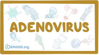 Adenovirus  an Osmosis Preview [upl. by Monda525]