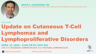 Update on Cutaneous TCell Lymphomas and Lymphoproliferative Disorders [upl. by Tartan]