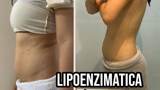 FIZ MINHA LIPOENZIMATICA E AMEI O RESULTADO 2 sessões [upl. by Sotsirhc]