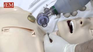 Simple Needle Cricothyroidotomy Options [upl. by Deerdre]