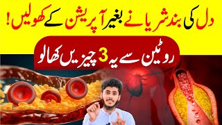 Artery Blockage Removal Naturally  Dil Ki Nali Kholne Ka Tarika  High Cholestrol Ka Ilaj Healthin [upl. by Cynthy799]