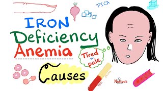 Iron Deficiency Anemia 12 [upl. by Massey]