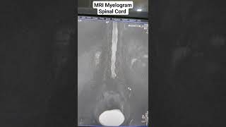 Uncover the Beginners Guide to MRI Spine Myelogram Sequences [upl. by Eelrihs]