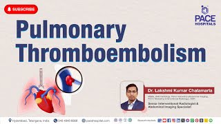 Pulmonary Thromboembolism PE  Cause Risk Factor Symptom Diagnosis Treatment amp Prevention [upl. by Aikram]