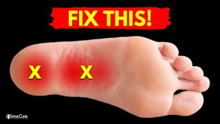 How to Relieve PLANTAR FASCIITIS Pain in Seconds [upl. by Acyssej]