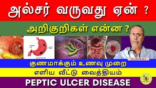 PEPTIC ULCER  SYMPTOMS CAUSES AND TREATMENT IN TAMIL FOODS TO CURE ULCER வயிற்றுப்புண் [upl. by Lemmueu]