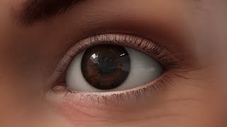 Glaucoma  MOA Animation [upl. by Nylram986]