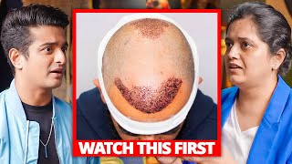 Before Your Hair Transplant Surgery Watch This  Top Dermat Dr Arika Bansal [upl. by Helali]