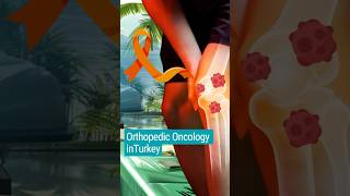 Orthopedic Oncology in Turkey Treatment of Bone Cancer shorts orthopedics oncology [upl. by Enamart]