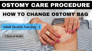 Ostomy Care Nursing Procedure I Adult health NursingI I Clinical Skills bsn nursingskills [upl. by Czarra]