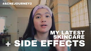 FIRST WEEK WITH ISOTRETINOIN ACNE JOURNEY 2 [upl. by Nyrtak]